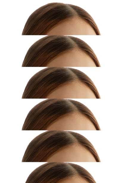 alt image missing